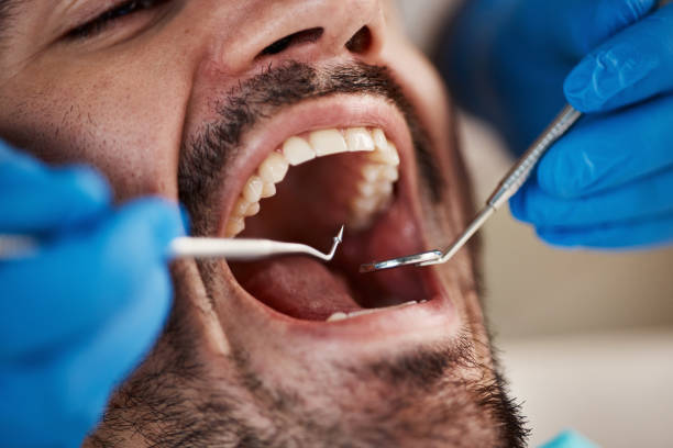 Best Emergency Dental Care for Trauma or Injury in Pocasset, MA