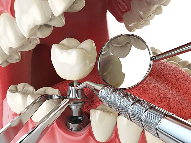 Best Emergency Treatment for Toothache in Pocasset, MA
