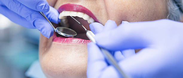 Best Emergency Root Canal Treatment in Pocasset, MA
